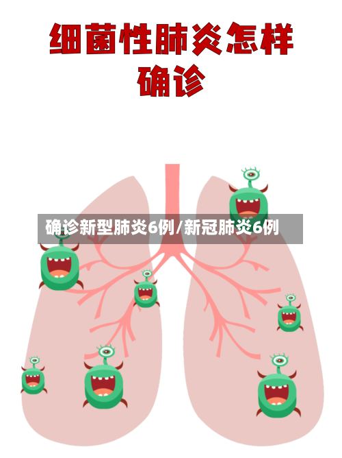 确诊新型肺炎6例/新冠肺炎6例-第2张图片